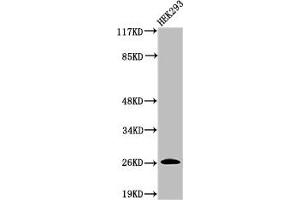 Western Blot analysis of 293 cells using Cleaved-C1r LC (I464) Polyclonal Antibody (C1R Antikörper  (Cleaved-Ile464))