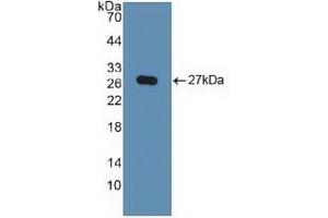 Detection of Recombinant KPNa2, Human using Polyclonal Antibody to Karyopherin Alpha 2 (KPNa2) (KPNA2 Antikörper  (AA 157-412))