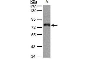 WB Image Sample(30 ug whole cell lysate) A:A431, 7. (ZNF7 Antikörper)
