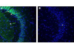 anti-MRS2 Magnesium Homeostasis Factor Homolog (MRS2) (AA 211-223), (Mitochondrial Matrix) antibody