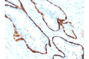 Immunohistochemistry (IHC) image for anti-Keratin 15 (KRT15) antibody (ABIN6939912)