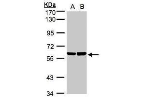 WB Image Sample(30 ug whole cell lysate) A:A431, B:Hep G2 , 7. (TBRG4 Antikörper)