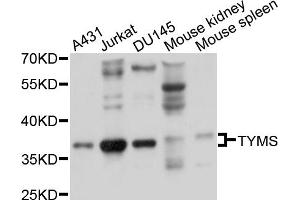 Western blot analysis of extracts of various cell lines, using TYMS antibody. (TYMS Antikörper)