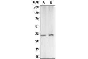 Western blot analysis of Carbonic Anhydrase 5A expression in K562 (A), A549 (B) whole cell lysates.