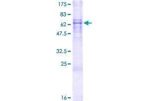 DAZ4 Protein (AA 1-390) (GST tag)