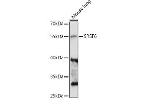 Western blot analysis of extracts of Mouse lung, using SRSF6 antibody (ABIN7270217) at 1:1000 dilution.