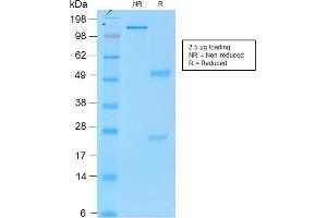 SDS-PAGE Analysis Purified Tyrosinase MouseRecombinantMonoclonal Antibody (rOCA1/812). (Rekombinanter TYR Antikörper)