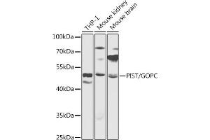 Western blot analysis of extracts of various cell lines, using PIST/PIST/GOPC antibody (ABIN6131712, ABIN6141275, ABIN6141277 and ABIN6217433) at 1:1000 dilution. (GOPC Antikörper  (AA 195-454))