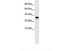 Image no. 2 for anti-Complement Component 4 Binding Protein, beta (C4BPB) (N-Term) antibody (ABIN6735849) (C4BPB Antikörper  (N-Term))