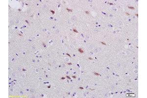 Formalin-fixed and paraffin embedded rat brain labeled with Anti-ADORA1 Polyclonal Antibody, Unconjugated  at 1:200 followed by conjugation to the secondary antibody and DAB staining (ADORA1 Antikörper  (AA 225-326))
