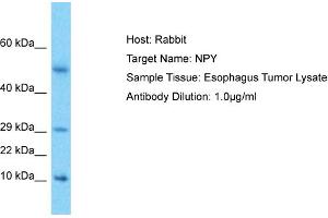 Host: Rabbit Target Name: NPY Sample Type: Esophagus Tumor lysates Antibody Dilution: 1. (NPY Antikörper  (Middle Region))
