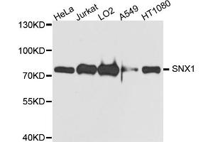 Western blot analysis of extracts of various cell lines, using SNX1 antibody. (Sorting Nexin 1 Antikörper)