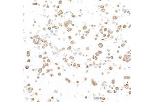 Immunocytochemistry (ICC) image for anti-Ubiquitin Carboxyl-terminal Esterase L1 (Ubiquitin Thiolesterase) (UCHL1) (AA 50-100) antibody (ABIN7449527) (Rekombinanter UCHL1 Antikörper  (AA 50-100))