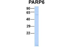 Host:  Rabbit  Target Name:  P Sample Type:  Human MCF7  Antibody Dilution:  1. (PARP6 Antikörper  (N-Term))