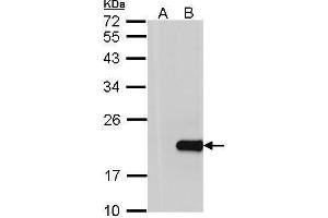 WB Image Western Blot analysis of HPCAL1 expression in transfected 293T cell line by HPCAL1 polyclonal antibody. (HPCAL1 Antikörper)