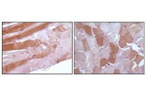 Immunohistochemical analysis of paraffin-embedded human skeletal muscle tissue showing cytoplasmic localization using anti-Myoglobin antibody with DAB staining. (Myoglobin Antikörper)