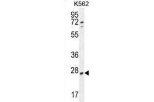 Western Blotting (WB) image for anti-Ribulose-5-Phosphate-3-Epimerase-Like (RPEL1) antibody (ABIN2995143) (Ribulose-5-Phosphate-3-Epimerase-Like (RPEL1) Antikörper)