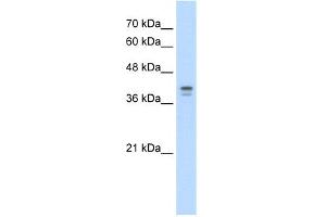 WB Suggested Anti-LOR Antibody Titration:  5.
