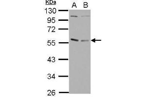 WB Image Sample (30 ug of whole cell lysate) A: Raji B: K562 10% SDS PAGE antibody diluted at 1:1000 (GABPA Antikörper  (N-Term))