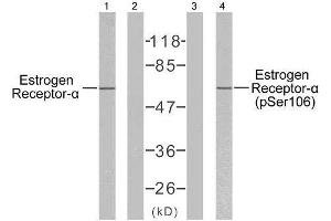 Western blot analysis of extracts from MCF7 cells using Estrogen Receptor-α (Ab-106) antibody (E021066) and Estrogen Receptor-α (phospho-Ser106) antibody (E011071). (Estrogen Receptor alpha Antikörper)