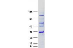 Validation with Western Blot