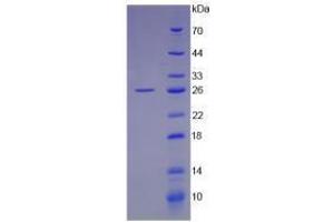 Image no. 2 for Leukemia Inhibitory Factor (LIF) (AA 2-201) (Active) protein (His tag) (ABIN6239785)