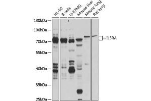 Western blot analysis of extracts of various cell lines, using IL5RA antibody (ABIN6132076, ABIN6142402, ABIN6142403 and ABIN6224648) at 1:1000 dilution. (IL5RA Antikörper  (AA 20-335))