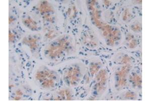 IHC-P analysis of Human Stomach Tissue, with DAB staining. (GDF6 Antikörper  (AA 336-455))