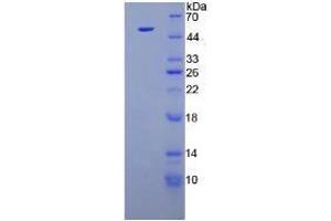 Image no. 1 for Fibroblast Growth Factor 1 (Acidic) (FGF1) (AA 1-155) (Active) protein (His tag,GST tag) (ABIN6239784) (FGF1 Protein (AA 1-155) (His tag,GST tag))