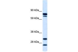 Western Blotting (WB) image for anti-Zinc Finger Protein 606 (ZNF606) antibody (ABIN2460763) (ZNF606 Antikörper)