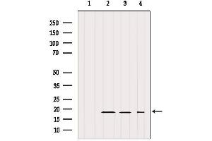 Western blot analysis of extracts from various samples, using IFT20 Antibody. (IFT20 Antikörper)