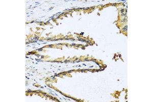 Immunohistochemistry of paraffin-embedded human prostate using GNRH1 antibody at dilution of 1:100 (40x lens). (GNRH1 Antikörper)