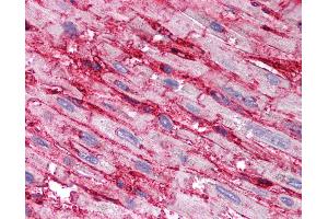 Immunohistochemistry (IHC) image for anti-CD36 (CD36) (AA 99-114) antibody (ABIN2618488)