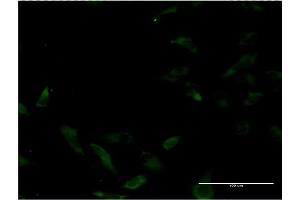 Immunofluorescence of monoclonal antibody to MUTYH on HeLa cell. (MUTYH Antikörper  (AA 436-535))
