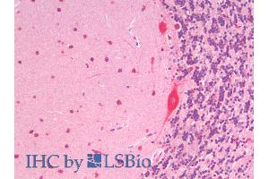 ABIN6391390 (5µg/ml) staining of paraffin embedded Human Cerebellum. (SLC7A6 Antikörper  (C-Term))