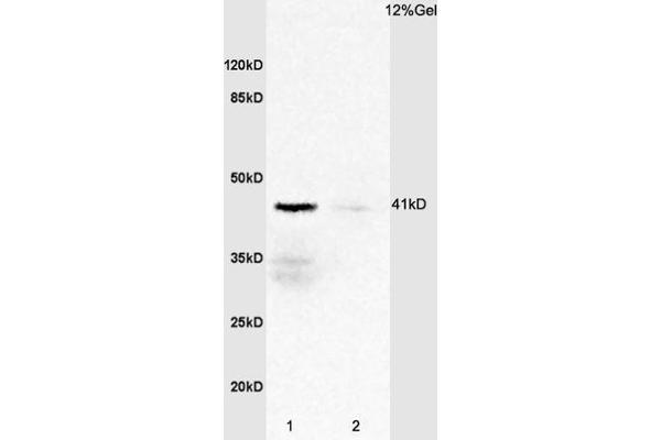 IL2RG Antikörper  (AA 51-150)