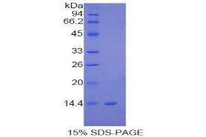 SDS-PAGE of Protein Standard from the Kit (Highly purified E. (S100B CLIA Kit)