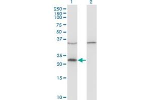 Western Blot analysis of VAX1 expression in transfected 293T cell line by VAX1 monoclonal antibody (M03), clone 2F4. (VAX1 Antikörper  (AA 1-100))