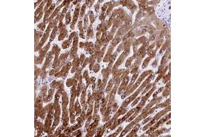 Immunohistochemical staining of human liver with RDH16 polyclonal antibody  shows strong cytoplasmic positivity in hepatocytes at 1:50-1:200 dilution. (RDH16 Antikörper)