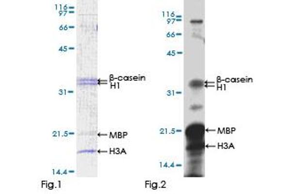 CAMK4 Protein (AA 1-473) (GST tag)