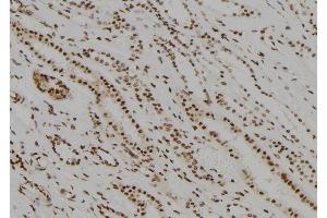 ABIN6279526 at 1/100 staining Human kidney tissue by IHC-P. (MED22 Antikörper  (Internal Region))