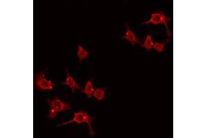 ABIN6274438 staining Hela by IF/ICC. (LMO3 Antikörper  (C-Term))