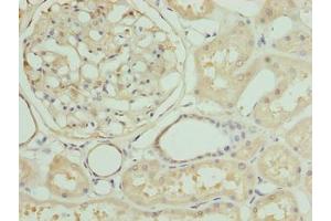 Immunohistochemistry of paraffin-embedded human kidney tissue using ABIN7161463 at dilution of 1:100 (ZNF274 Antikörper  (AA 1-320))