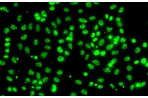 Immunofluorescence analysis of A549 cells using CSRNP1 Polyclonal Antibody (AXUD1 Antikörper)