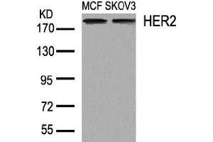 Image no. 2 for anti-Receptor tyrosine-protein kinase erbB-2 (ErbB2/Her2) (AA 1246-1250) antibody (ABIN197227) (ErbB2/Her2 Antikörper  (AA 1246-1250))