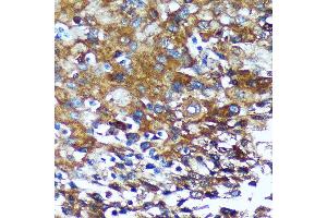 Immunohistochemistry (IHC) image for anti-G-Rich RNA Sequence Binding Factor 1 (GRSF1) antibody (ABIN7267319)
