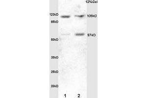 SDS-PAGE (SDS) image for anti-Heat Shock Factor Protein 1 (HSF1) (AA 351-450) antibody (ABIN703676)