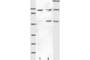 Lane 1: mouse embryo lysates Lane 2:rat brain lysates probed with Anti HSF1 Polyclonal Antibody, Unconjugated (ABIN703676) at 1:200 in 4 °C. (HSF1 Antikörper  (AA 351-450))