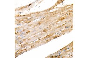 Immunohistochemistry of paraffin-embedded rat heart using PGC1α Rabbit mAb  at dilution of 1:1000 (40x lens). (PPARGC1A Antikörper)
