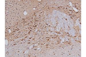ABIN6267326 at 1/200 staining Rat brain tissue sections by IHC-P. (Tyrosine Hydroxylase Antikörper  (pSer40))
